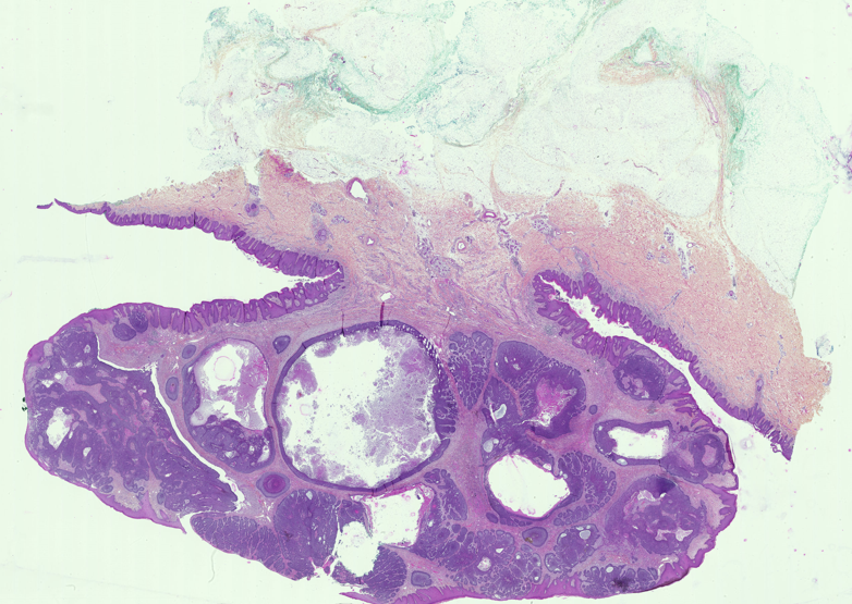 Celulle avant extraction du contour