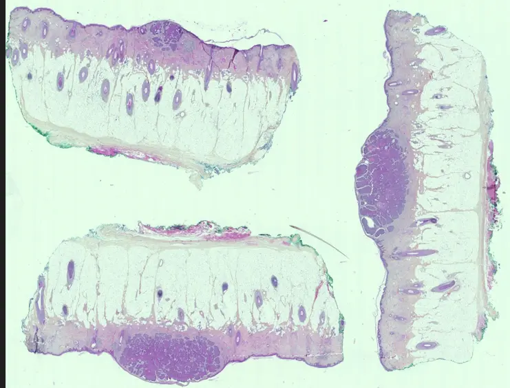 Plusieurs membranes sur une même lame