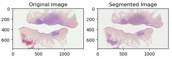 Image d'origine vs Image segmentée